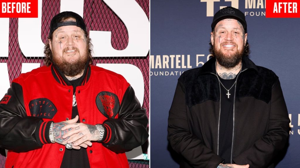 A side-by-side comparison illustrating the Jelly Roll Weight Loss transformation. On the left, a photo from 2022 at his heaviest weight of over 500 pounds, and on the right, a recent photo from early 2026 showing him at 265 pounds after losing more than half his body weight.