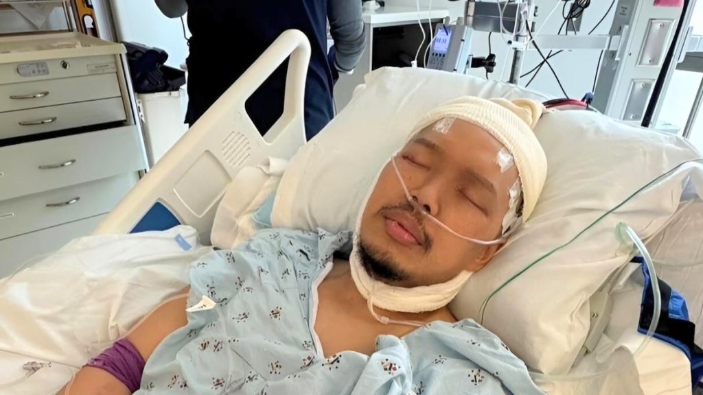 A close-up, somber image of Alex Duong resting in a hospital bed. He has a white medical wrap around his head and chin and a nasal cannula for oxygen. This image reflects his final brave battle with rare cancer before his passing on March 28, 2026.