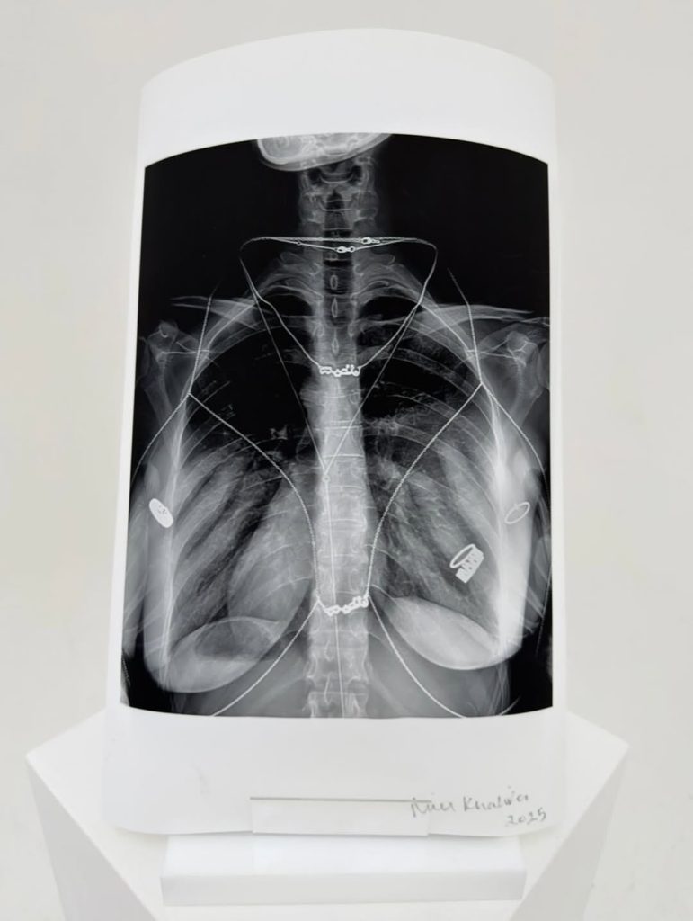 A monochrome X-ray image of a human torso on display, featuring visible skeletal structures and jewelry. The piece is signed "Mia Khalifa 2025" at the bottom. This artwork has been a central topic in recent Mia Khalifa News regarding her creative collaborations and efforts to redefine her public image through artistic expression.